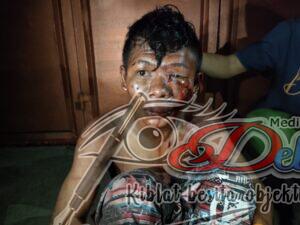 Kepergok Curi Motor, Wajah Komeng Dibuat Tak Beraturan