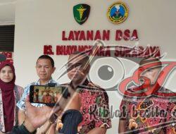 Kini RS Bhayangkara Polda Jatim di Surabaya Miliki Layanan DSA
