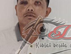 Tak Beraturan Usai Diamuk Massa, Pencuri Motor Di Kapas Lor Ditangkap Polisi